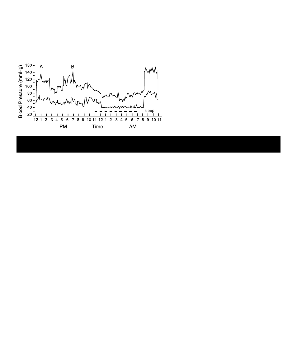 Important information before use, Variations in blood pressure | MABIS/Duro-Med Semi-Automatic Blood Pressure Monitor User Manual | Page 7 / 14