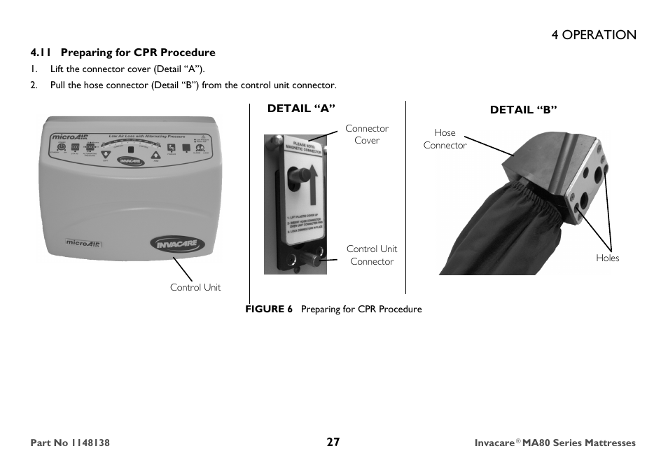 11 preparing for cpr procedure, Lift the connector cover (detail “a”), Connector cover | 4 operation | Invacare MA85 User Manual | Page 27 / 36
