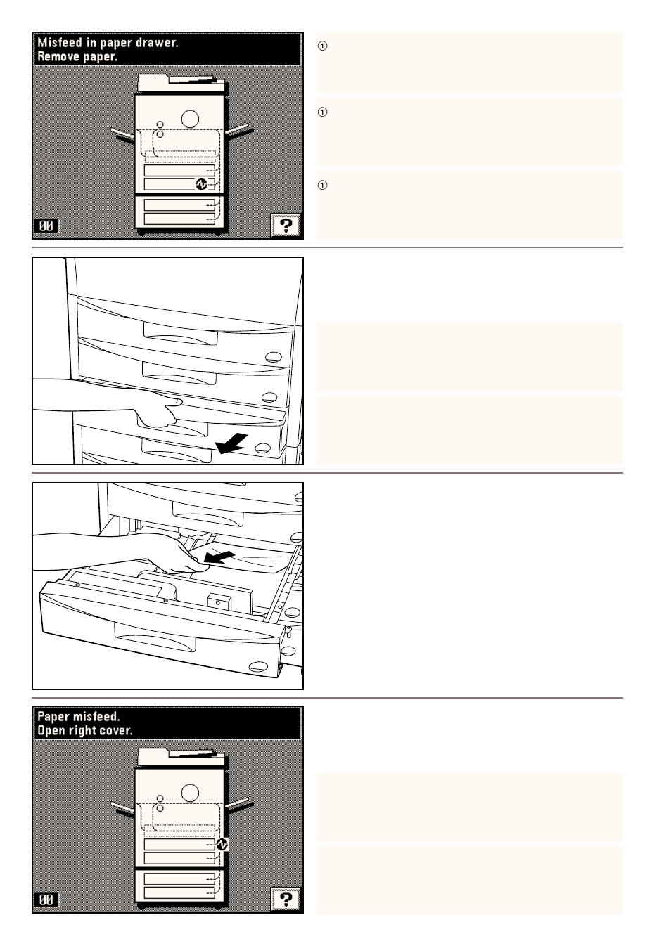 3) removal procedures | Kyocera 4230 User Manual | Page 182 / 226