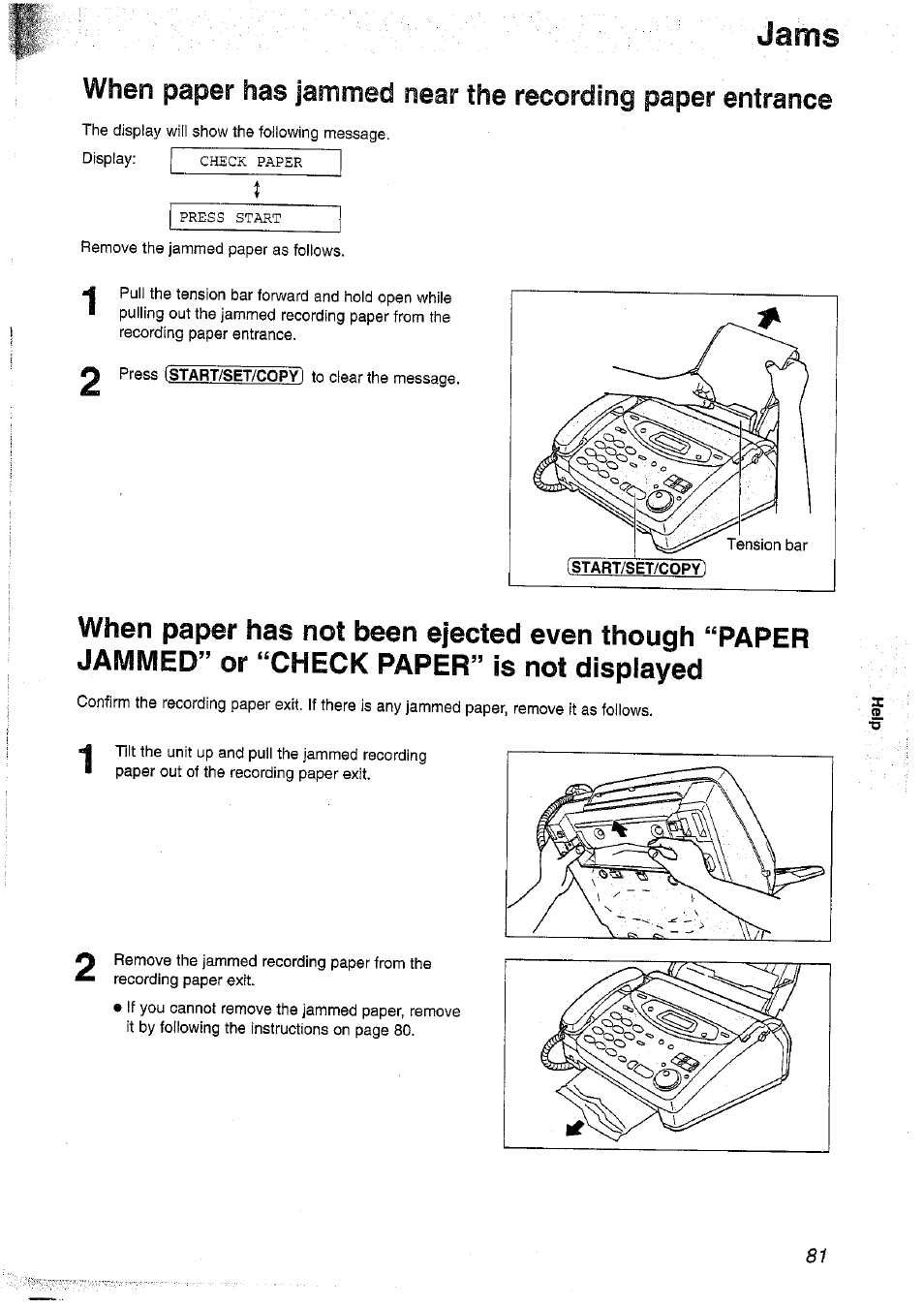 Jams | Panasonic KX-FP101NZ User Manual | Page 81 / 96