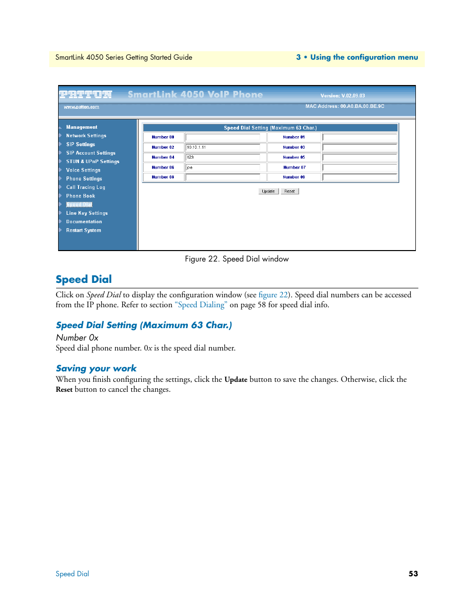 Speed dial, Speed dial setting (maximum 63 char.), Number 0x | Saving your work, Speed dial window | Patton electronic SL4050/10 User Manual | Page 53 / 75