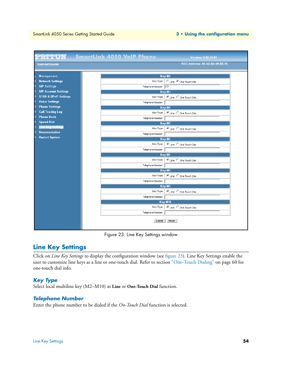 Line key settings, Key type, Telephone number | Line key settings window | Patton electronic SL4050/10 User Manual | Page 54 / 75