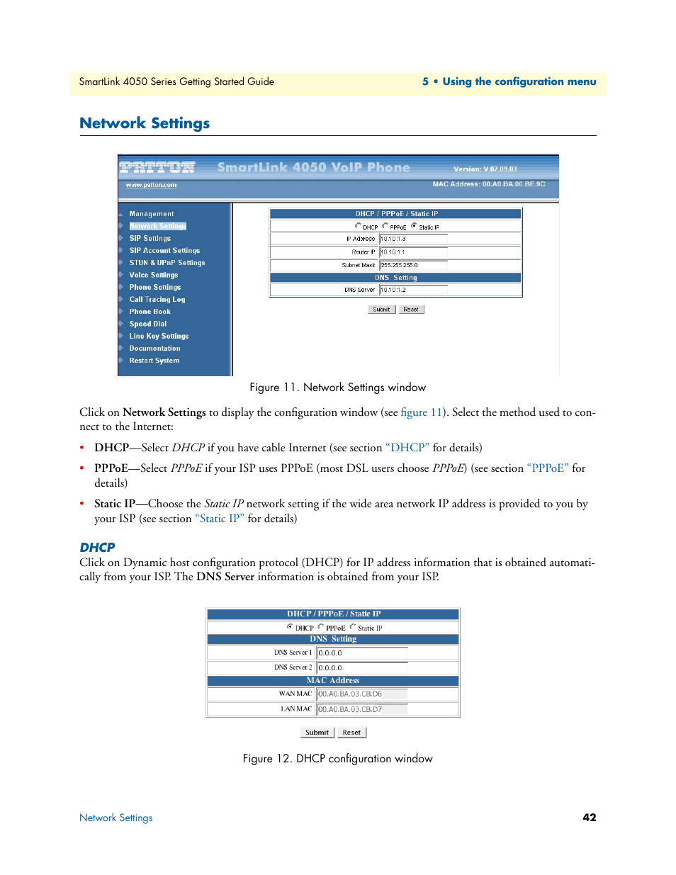 Network settings, Dhcp, Network settings window | Dhcp configuration window | Patton electronic SL4050/B2/E User Manual | Page 42 / 79
