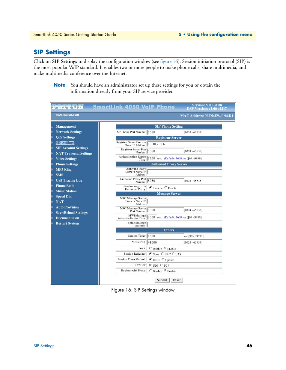 Sip settings, Sip settings window | Patton electronic SL4050/B2/E User Manual | Page 46 / 79