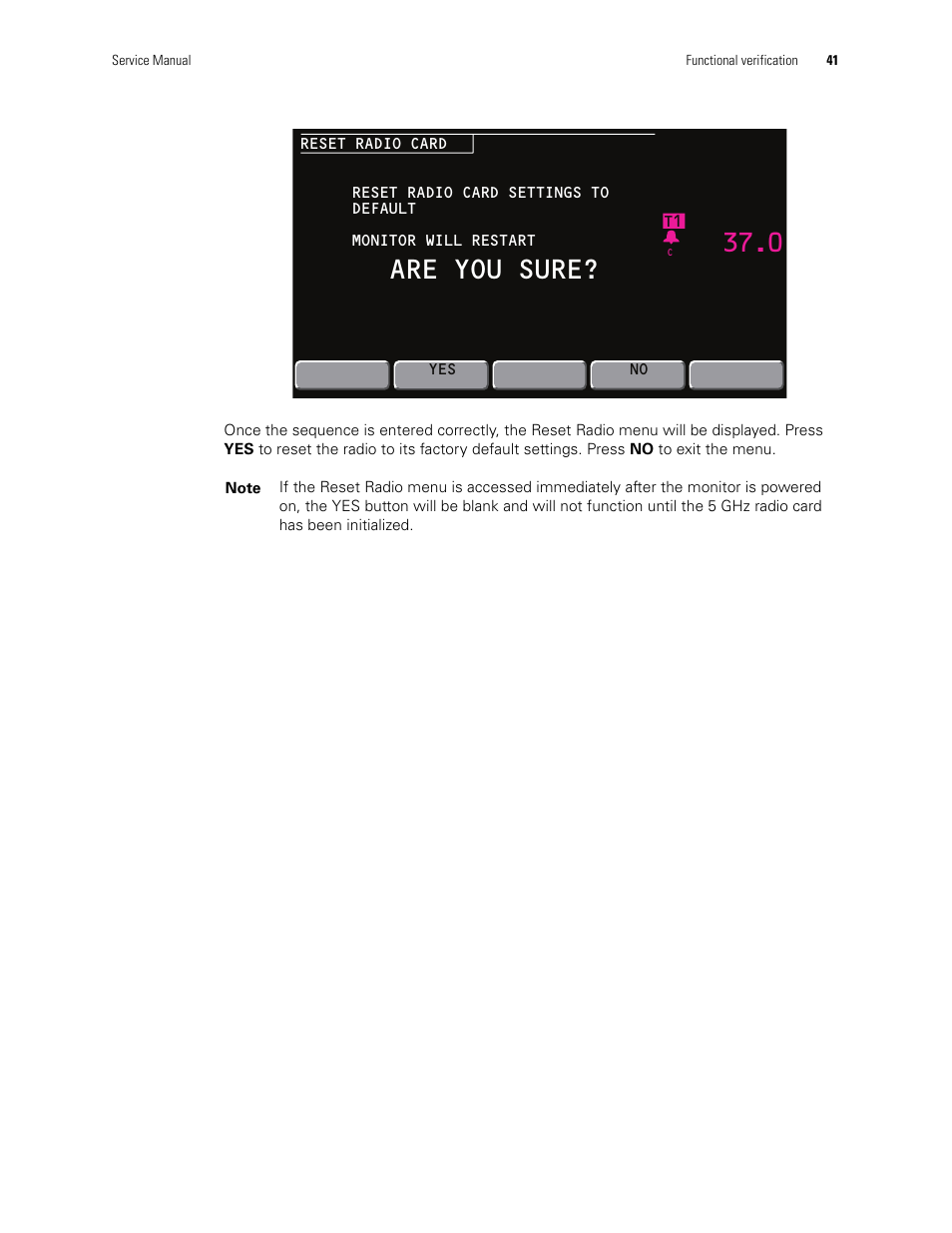 Are you sure | Welch Allyn PROPAQ CS User Manual | Page 45 / 142