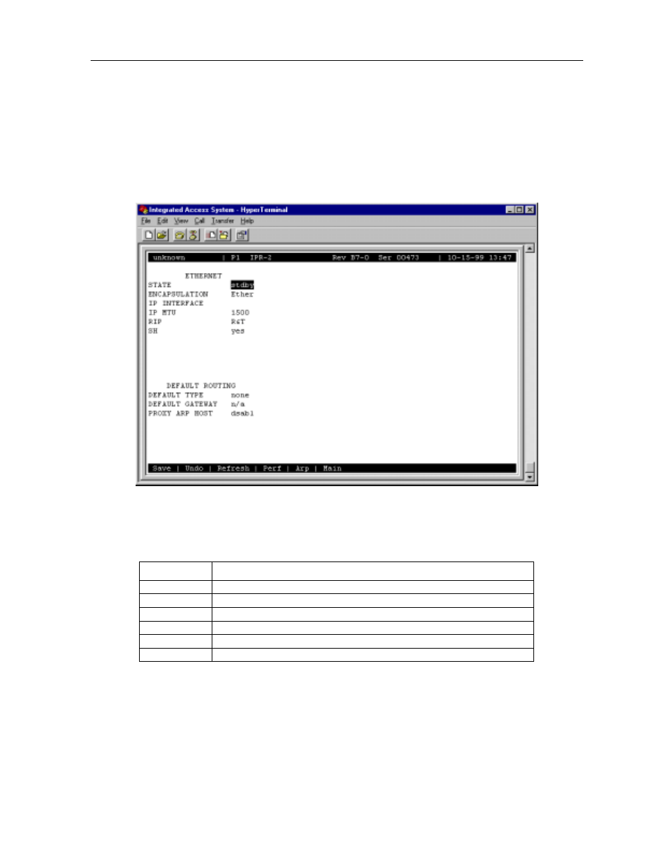 2 ethernet and default ip screen | Zhone Technologies 800 User Manual | Page 119 / 138