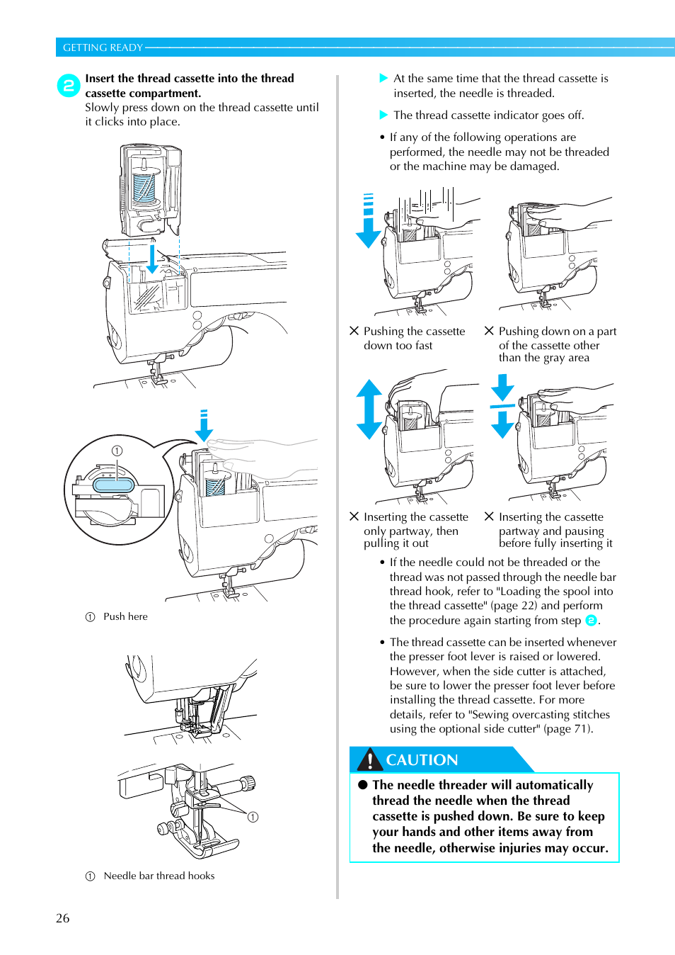 Caution | Brother SE-270D User Manual | Page 32 / 166