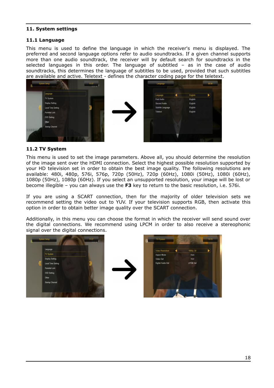 System settings, 1 language, 2 tv system | Ferguson Ariva T650i User Manual | Page 18 / 39