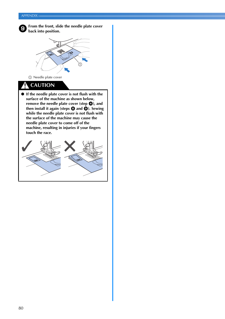 Caution | Brother V61 User Manual | Page 82 / 100