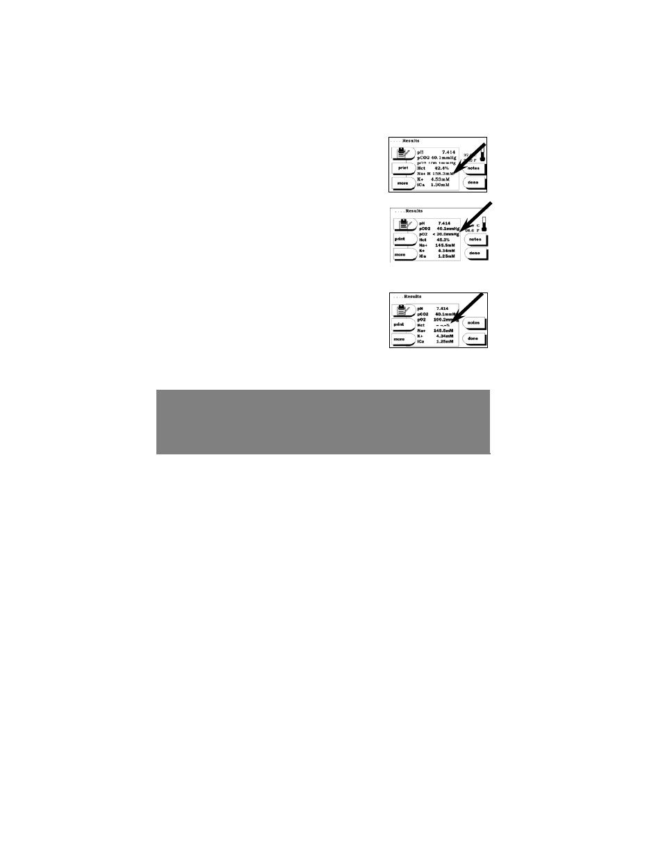 ITC IRMA TruPoint Blood Analysis System User Manual | Page 42 / 170