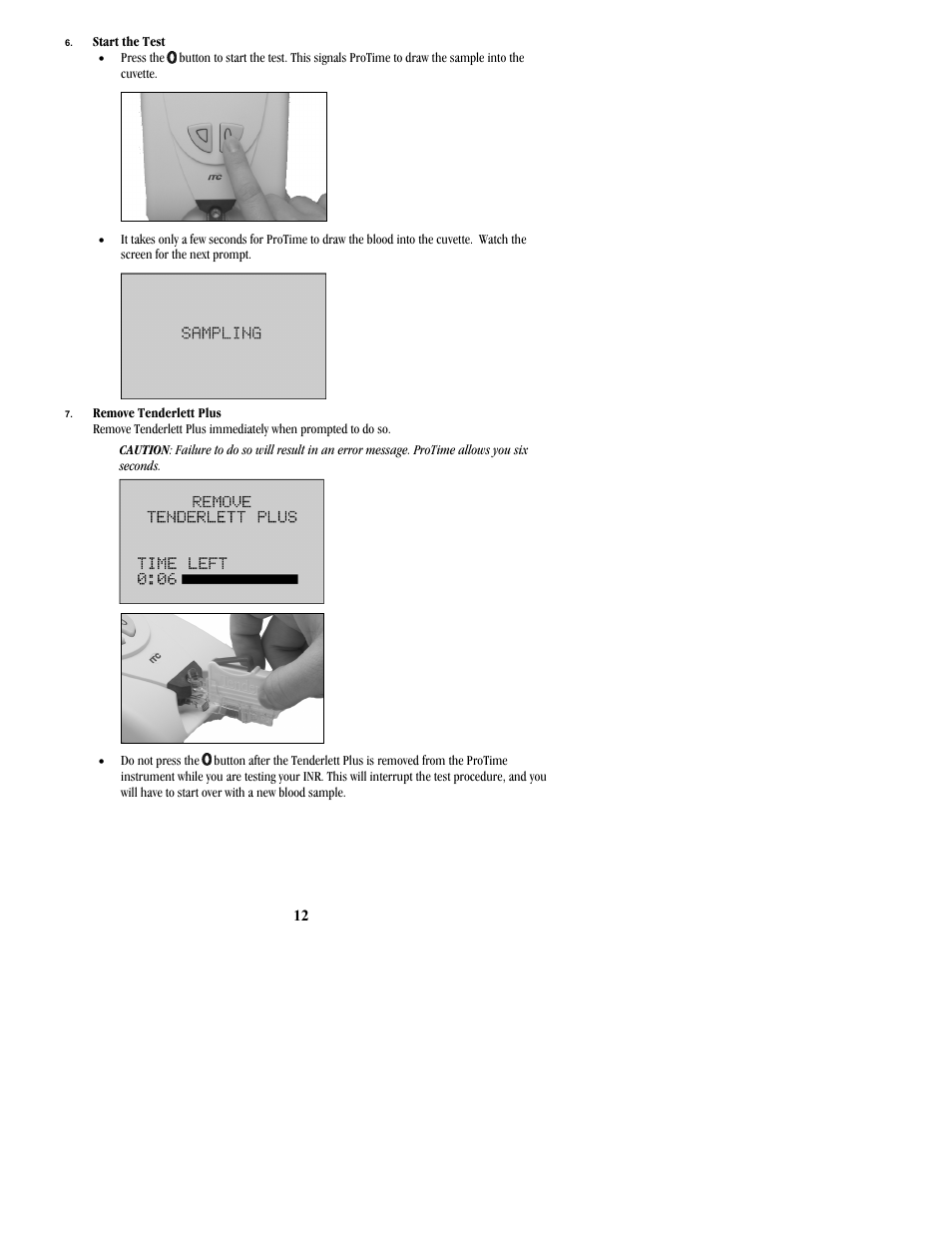 ITC ProTime Microcoagulation System User Manual | Page 12 / 36