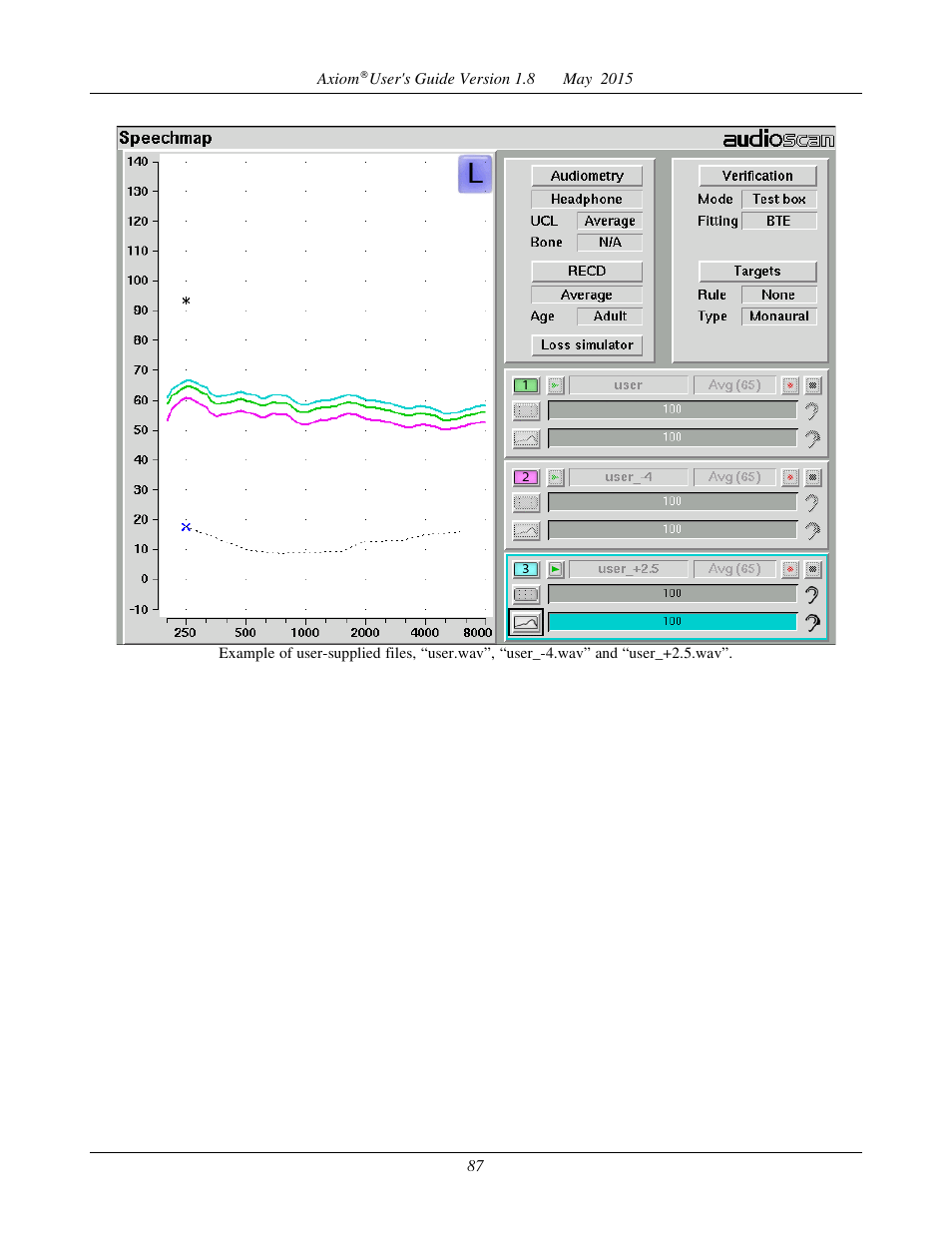 18 speechmap fitting procedures, Speechmap screen choices | Audioscan Axiom User Manual | Page 87 / 130