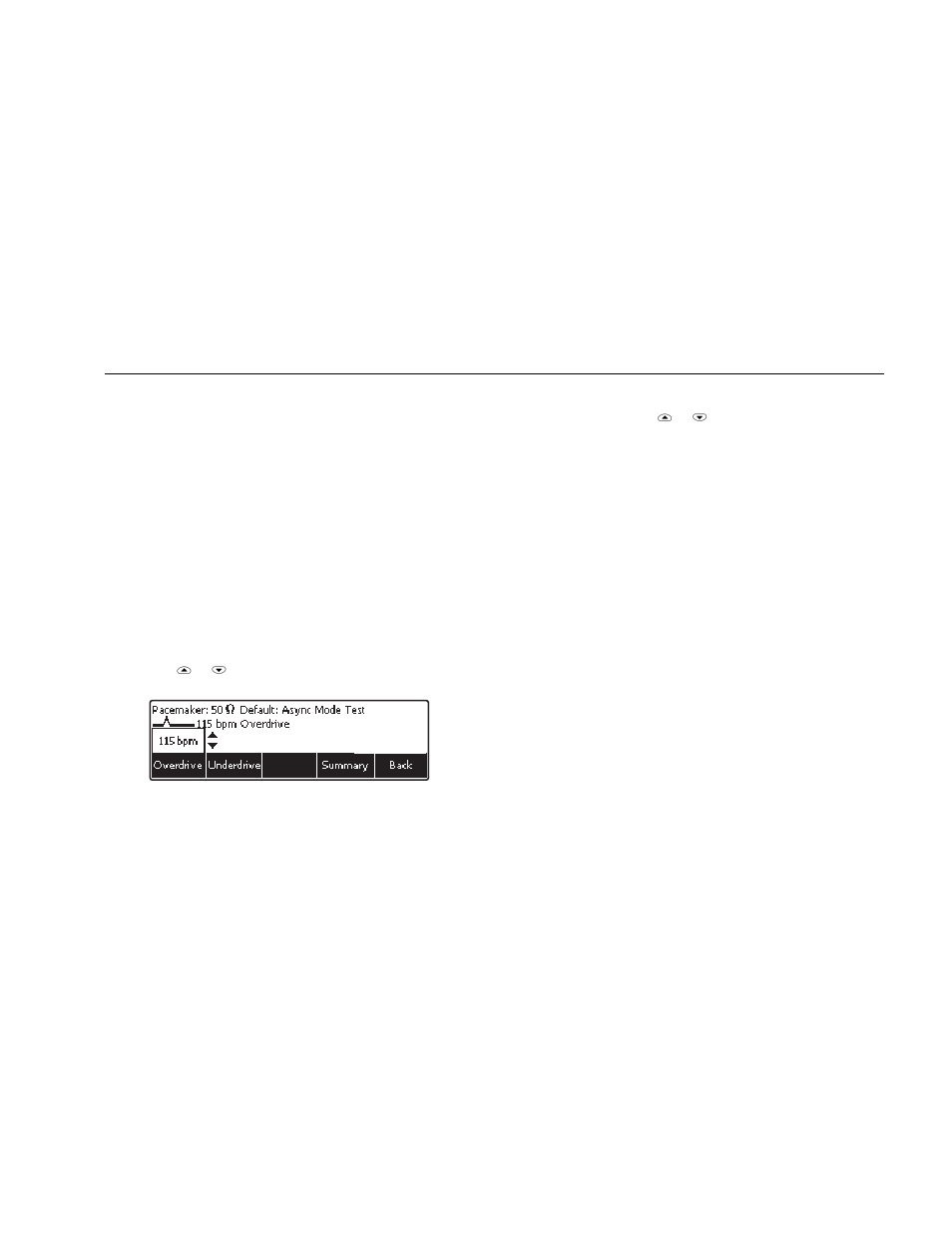 Performing a pacer demand test | Fluke Biomedical 6000D Impulse User Manual | Page 29 / 92