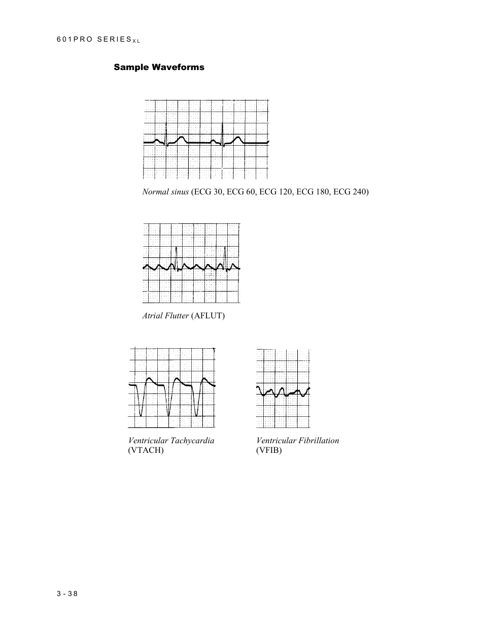 Ecg output | Fluke Biomedical 601PRO XL User Manual | Page 78 / 186