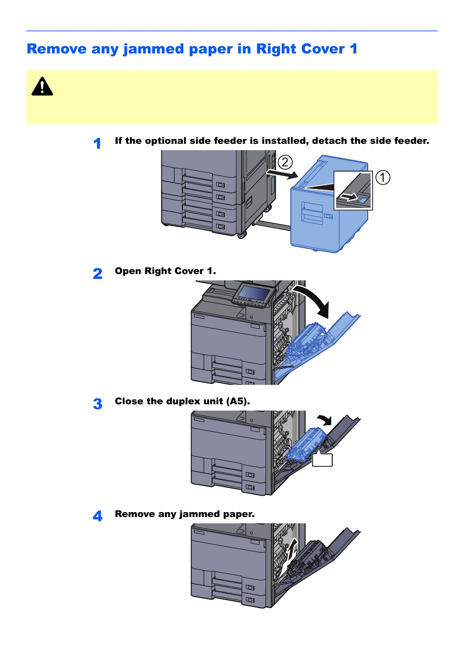 Remove any jammed paper in right cover 1, Remove any jammed paper in right cover 1 -74 | Kyocera TASKalfa 2552ci User Manual | Page 585 / 682