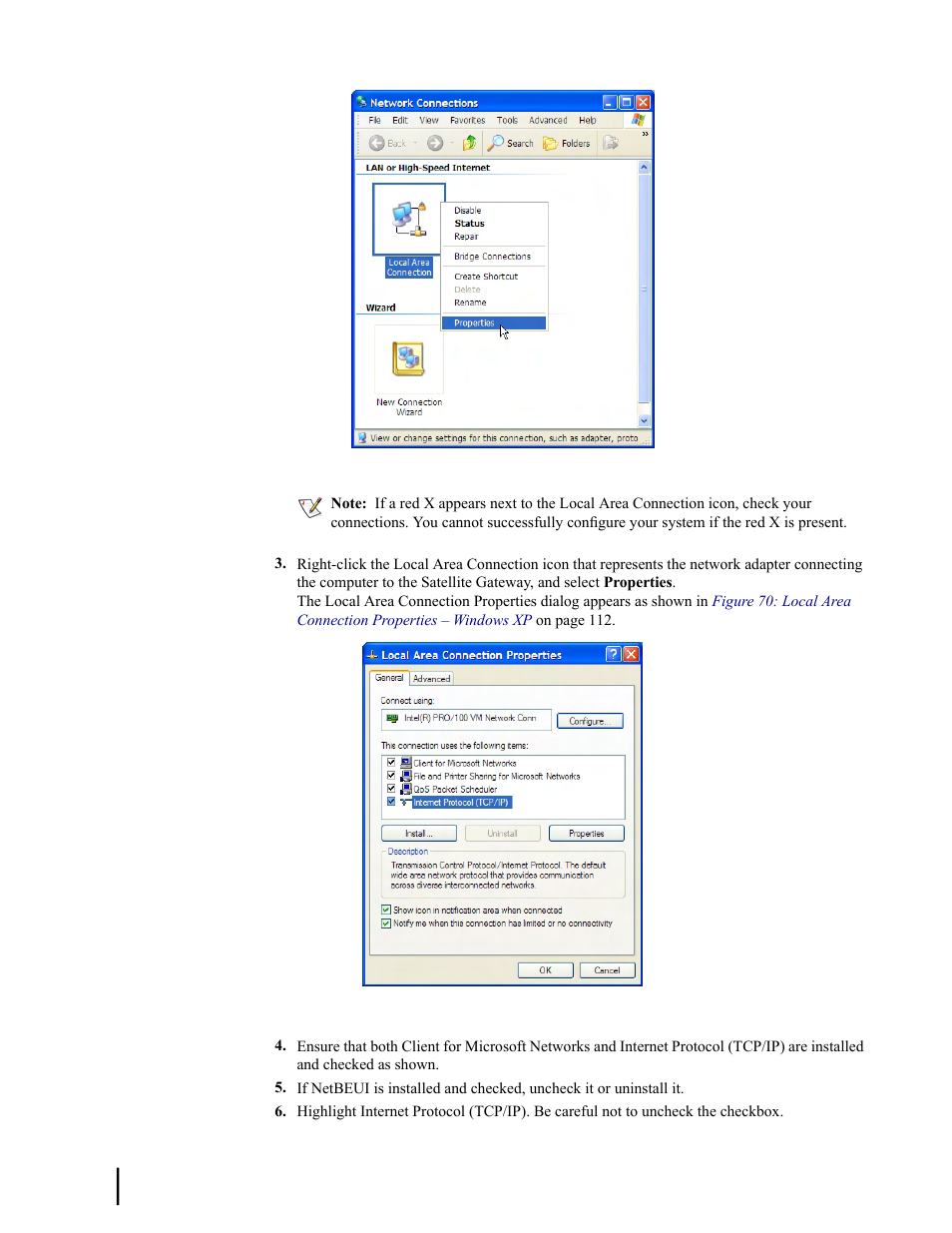 Figure 69: network connections – windows xp, Figure 69: network connections – windows | Hughes SATELLITE HN9000 User Manual | Page 128 / 154