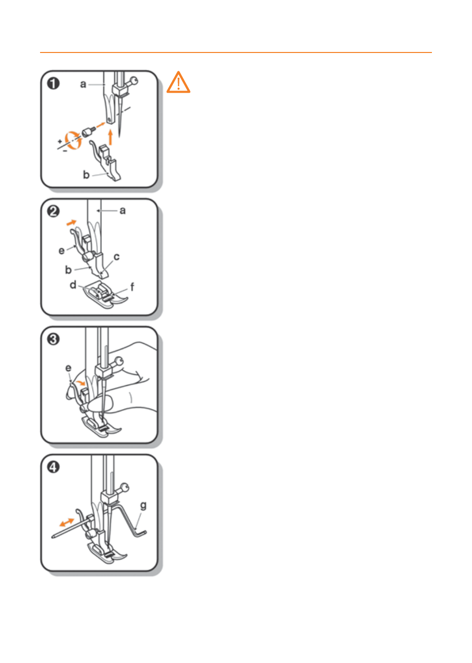 Presser foot shank | Husqvarna E20 User Manual | Page 11 / 36