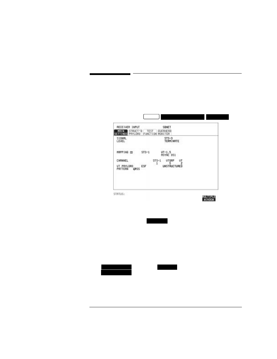 Setting sonet receive interface, Setting sonet receive interface 17 | HP OMNIBER 718 HP 37718A User Manual | Page 27 / 190