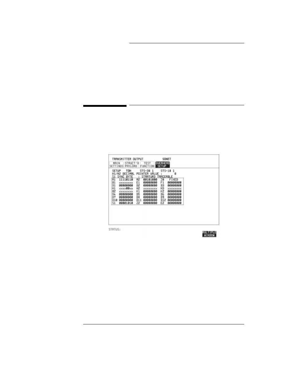 Using transmit overhead setup, Using transmit overhead setup 22, Selecting test features | HP OMNIBER 718 HP 37718A User Manual | Page 32 / 190