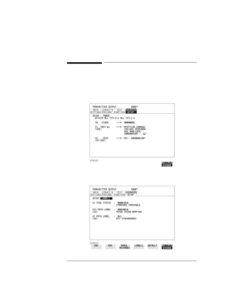 Setting overhead trace messages, Setting overhead trace messages 26 | HP OMNIBER 718 HP 37718A User Manual | Page 36 / 190