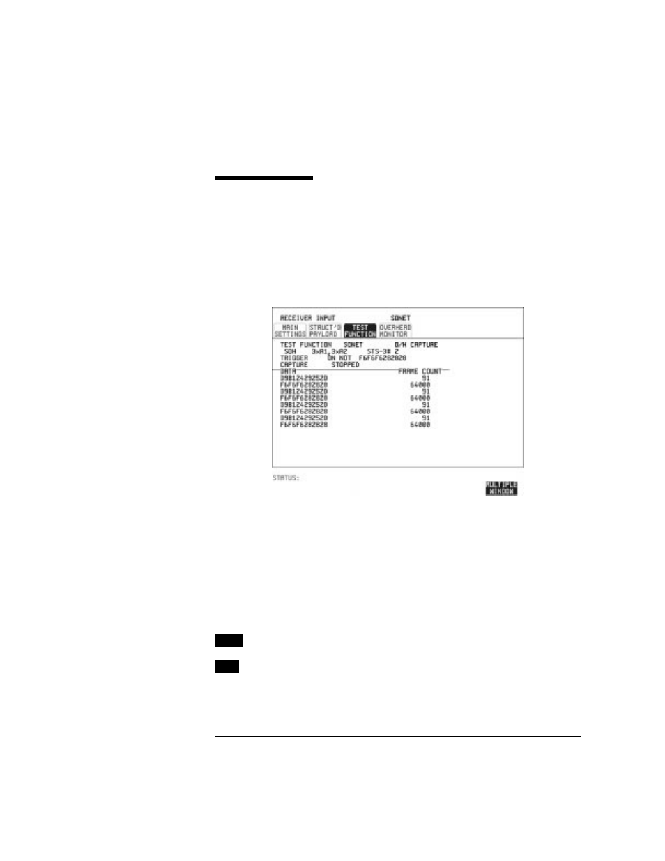 Using receive overhead capture, Using receive overhead capture 29 | HP OMNIBER 718 HP 37718A User Manual | Page 39 / 190