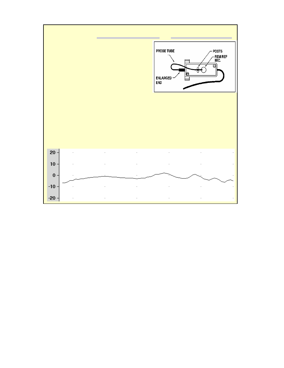 HP RM500SL User Manual | Page 51 / 112