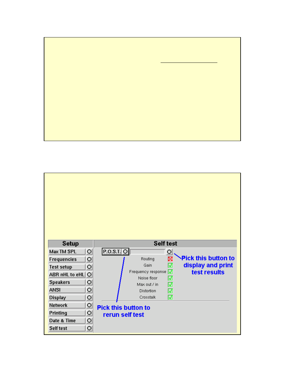 HP RM500SL User Manual | Page 88 / 112