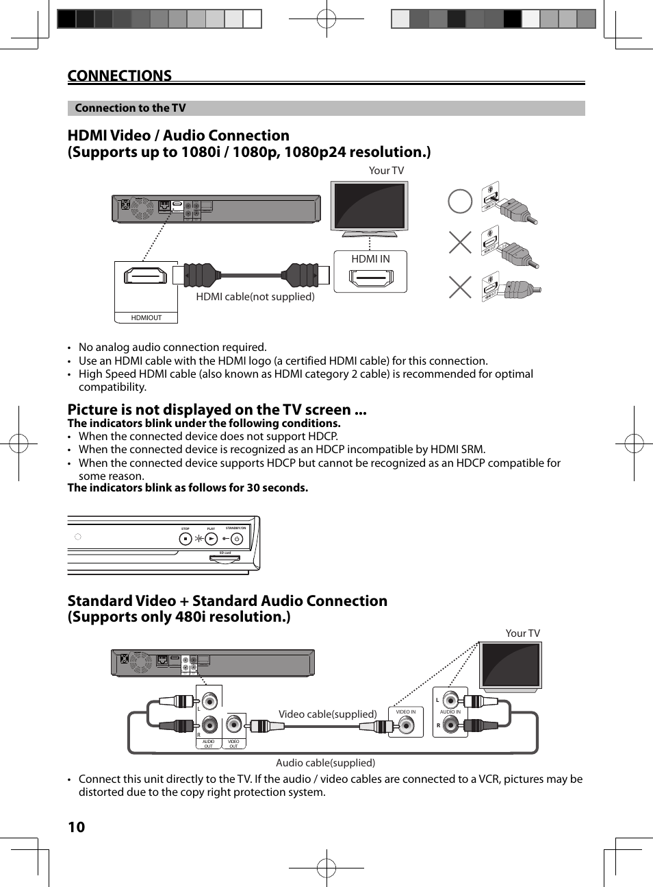 Connections, Connection to the tv, 10 connections | Picture is not displayed on the tv screen, Hdmi in hdmi cable(not supplied) your tv, Your tv, Video cable(supplied) audio cable(supplied) | FUNAI MBP5130/F7 User Manual | Page 10 / 52