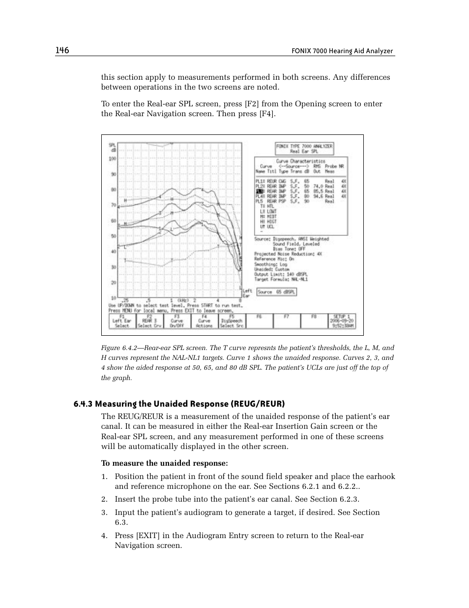 3 measuring the unaided response (reug/reur) | Frye FONIX 7000 User Manual | Page 154 / 216