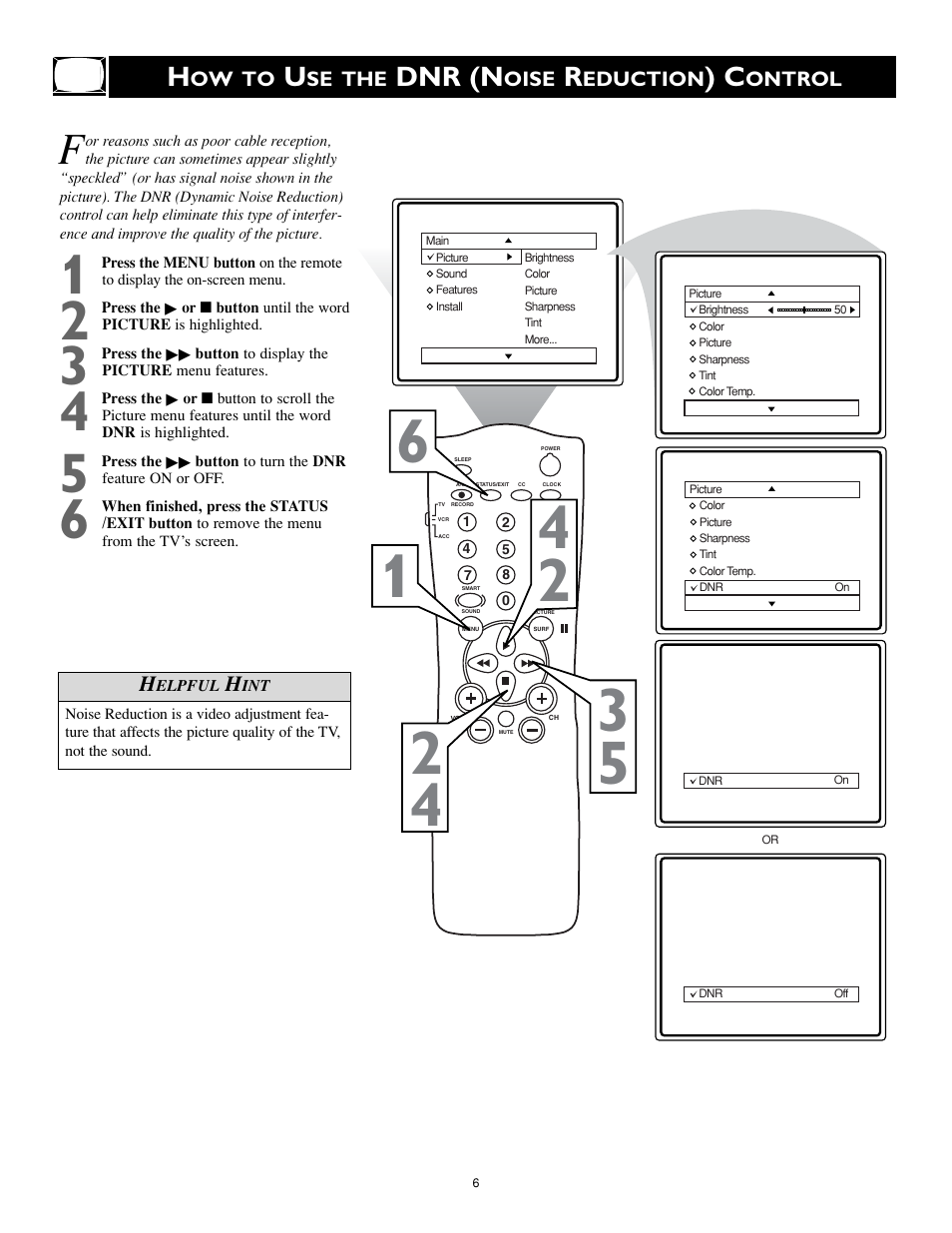 Dnr (n | Philips Magnavox MS3252S MS3652S User Manual | Page 6 / 40