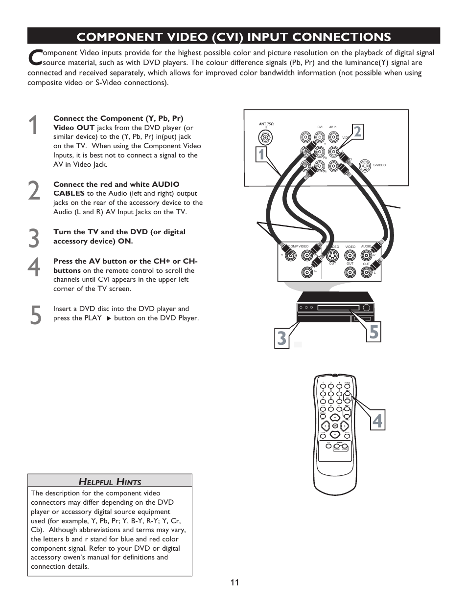 Component video (cvi) input connections | Philips Magnavox 20MT4405 User Manual | Page 11 / 34