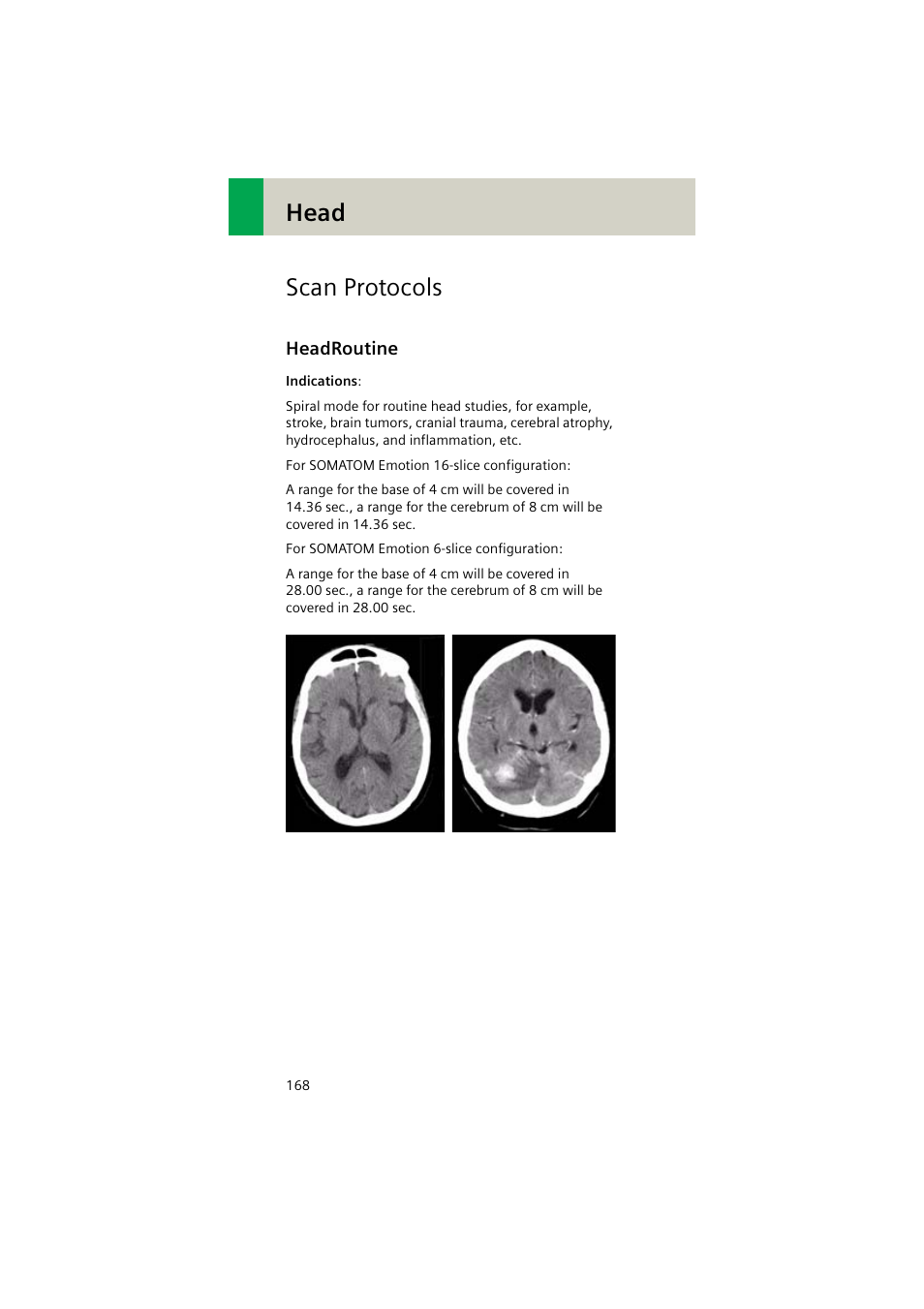 Scan protocols, Headroutine, Headroutine 168 | Head scan protocols | Siemens EMOTION 16-Jun User Manual | Page 168 / 590