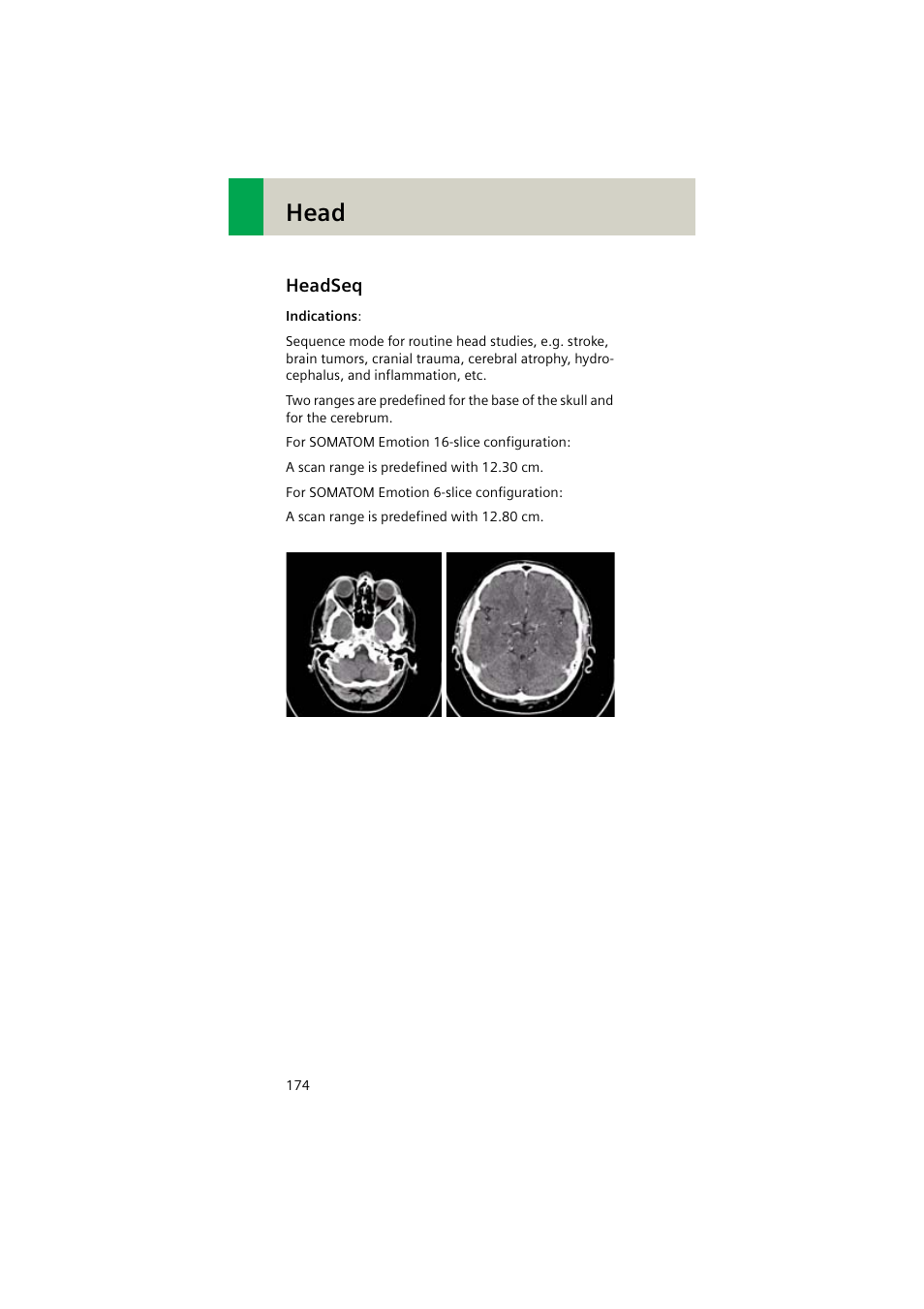 Headseq, Headseq 174, Head | Siemens EMOTION 16-Jun User Manual | Page 174 / 590