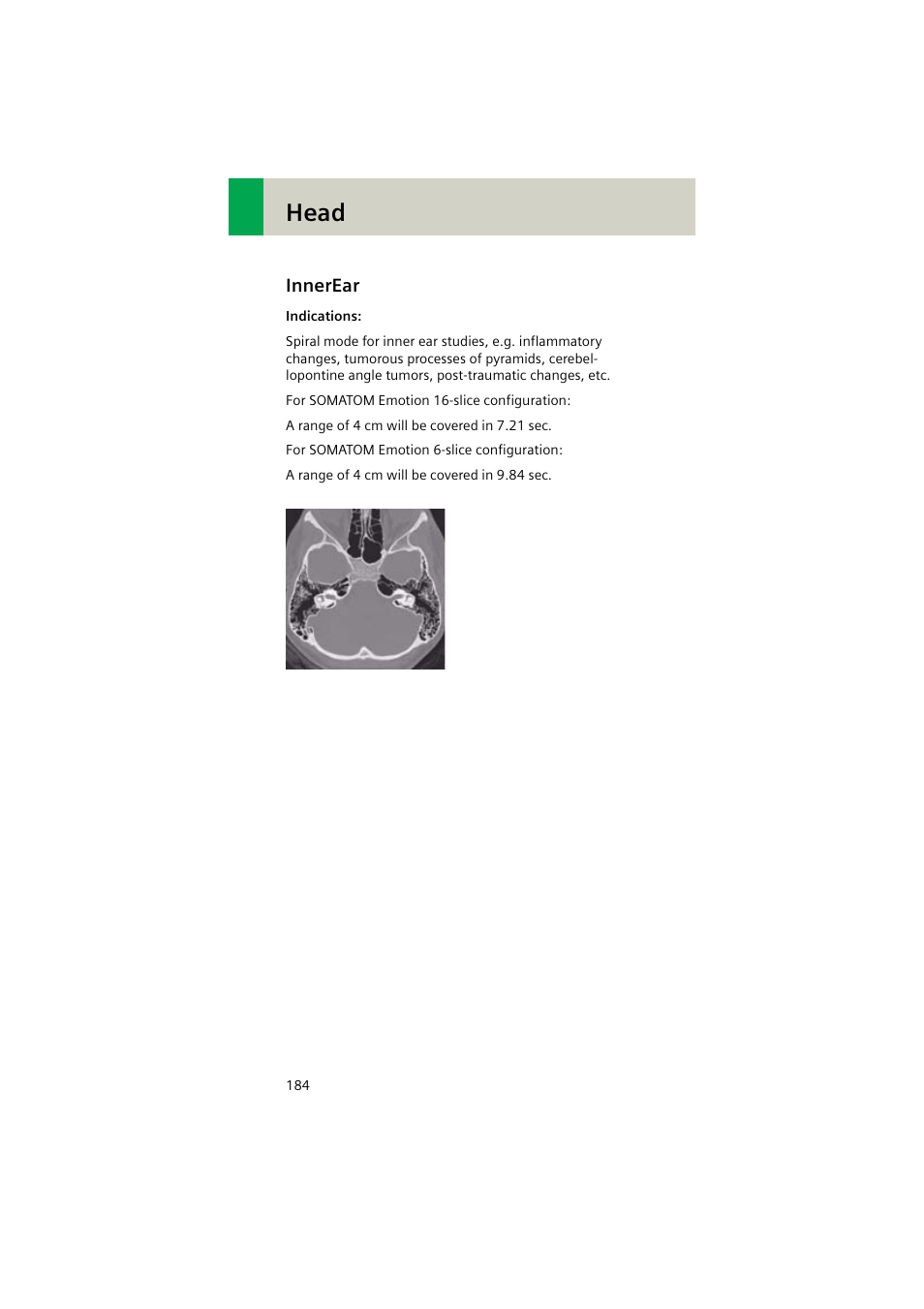 Innerear, Innerear 184, Head | Siemens EMOTION 16-Jun User Manual | Page 184 / 590