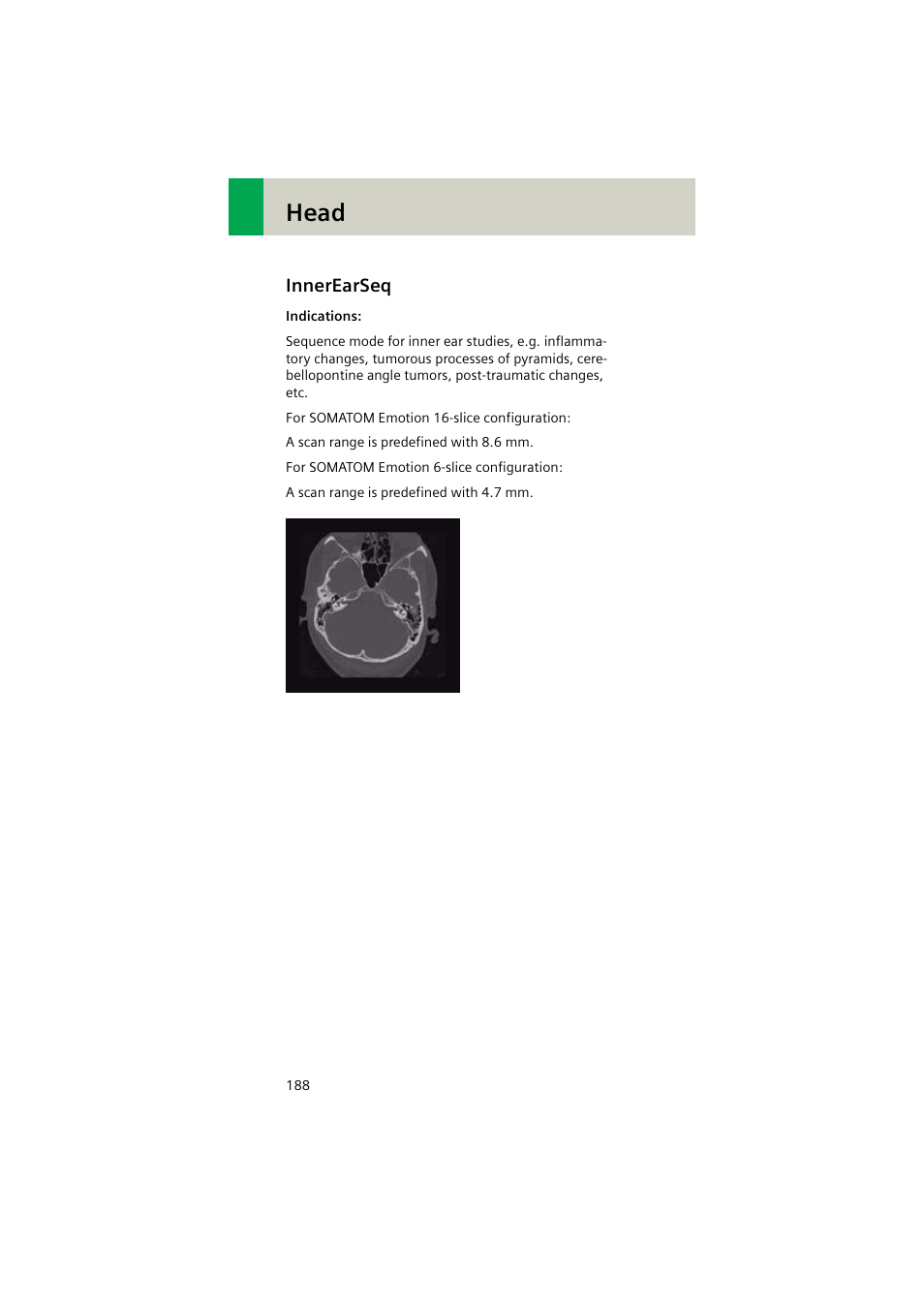 Innerearseq, Innerearseq 188, Head | Siemens EMOTION 16-Jun User Manual | Page 188 / 590