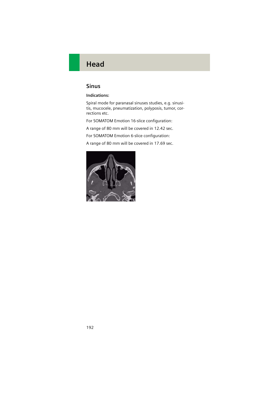 Sinus, Sinus 192, Head | Siemens EMOTION 16-Jun User Manual | Page 192 / 590