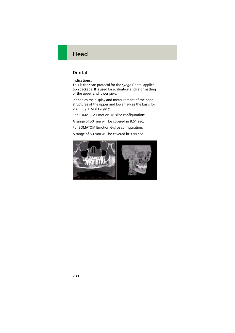 Dental, Dental 200, Head | Siemens EMOTION 16-Jun User Manual | Page 200 / 590