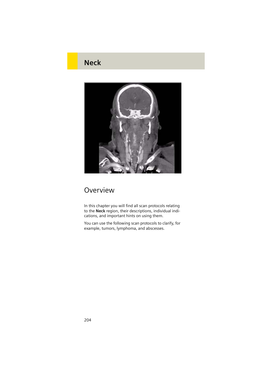 Neck, Overview | Siemens EMOTION 16-Jun User Manual | Page 204 / 590