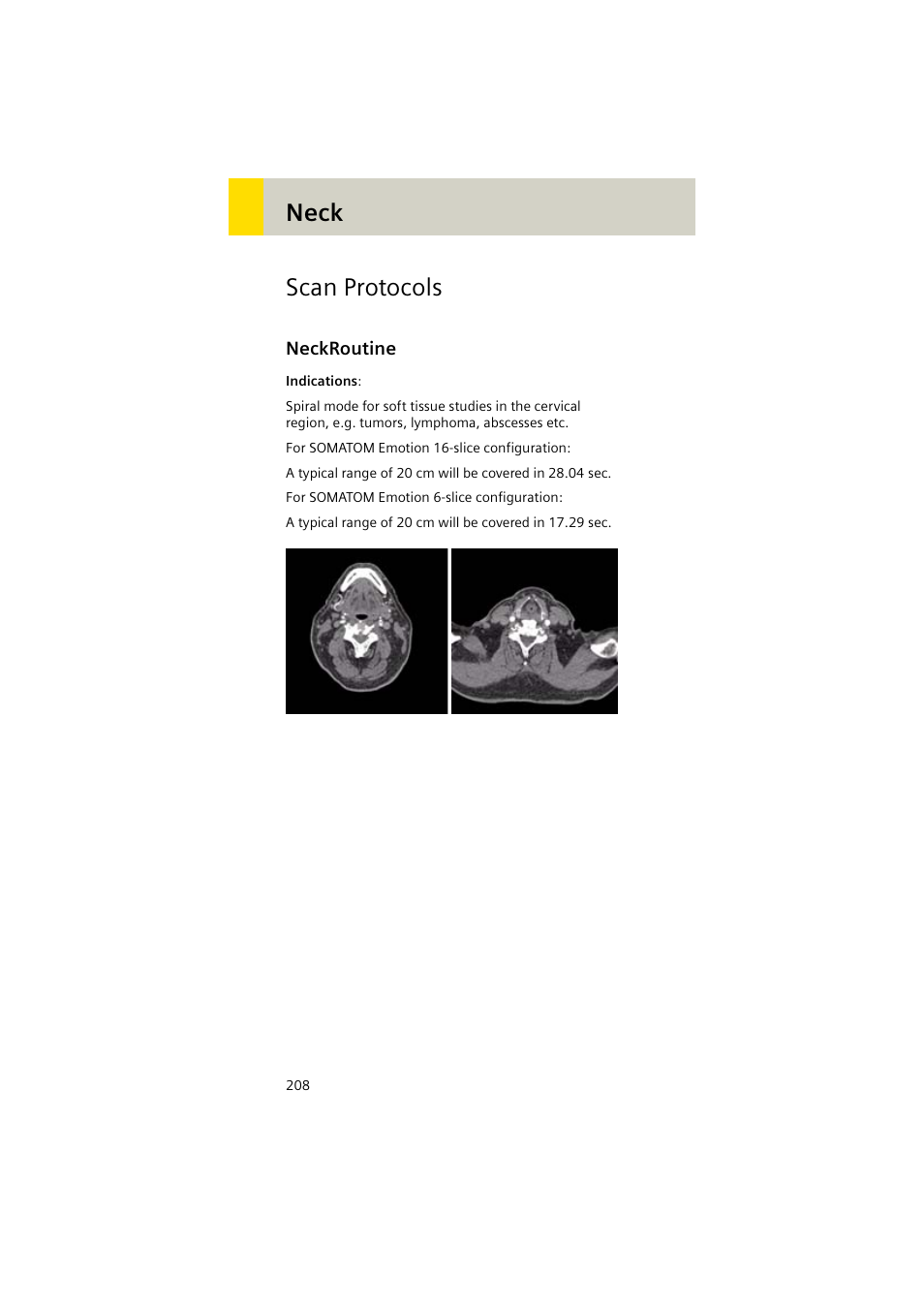 Scan protocols, Neckroutine, Neckroutine 208 | Neck scan protocols | Siemens EMOTION 16-Jun User Manual | Page 208 / 590