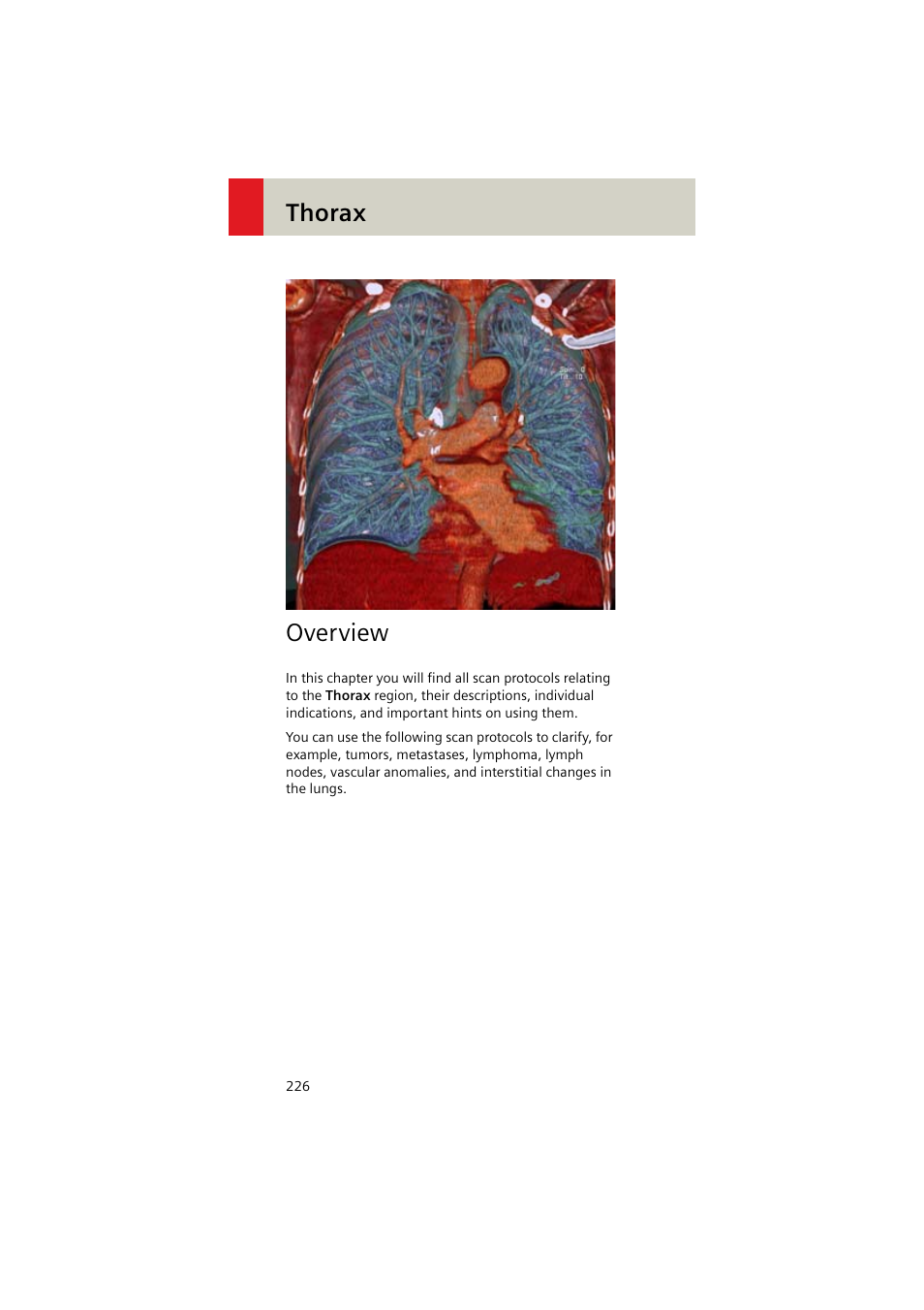 Thorax, Overview | Siemens EMOTION 16-Jun User Manual | Page 226 / 590