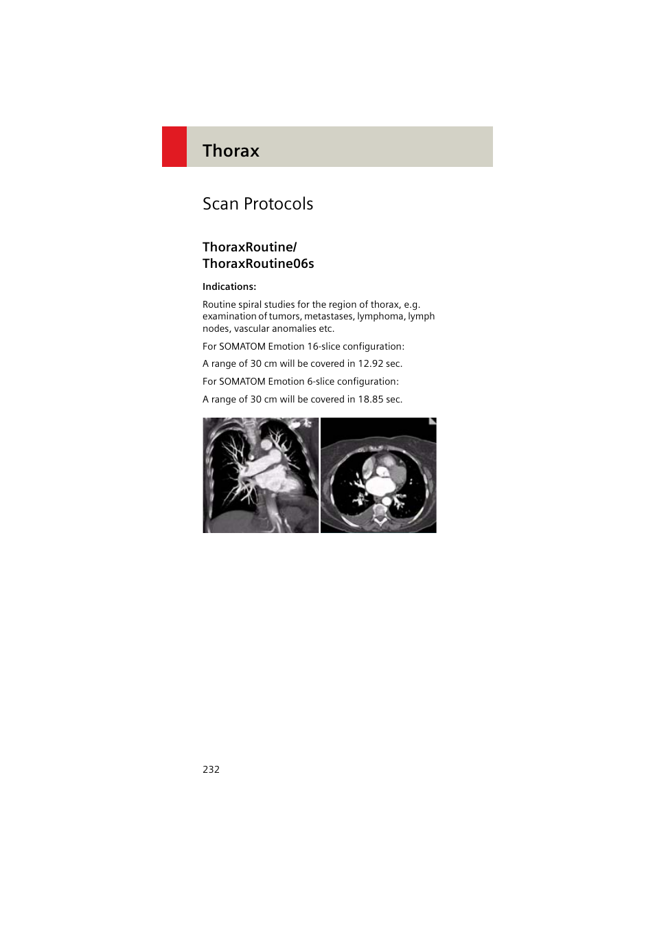 Scan protocols, Thoraxroutine/ thoraxroutine06s, Thoraxroutine | Thoraxroutine06s 232, Thorax scan protocols | Siemens EMOTION 16-Jun User Manual | Page 232 / 590