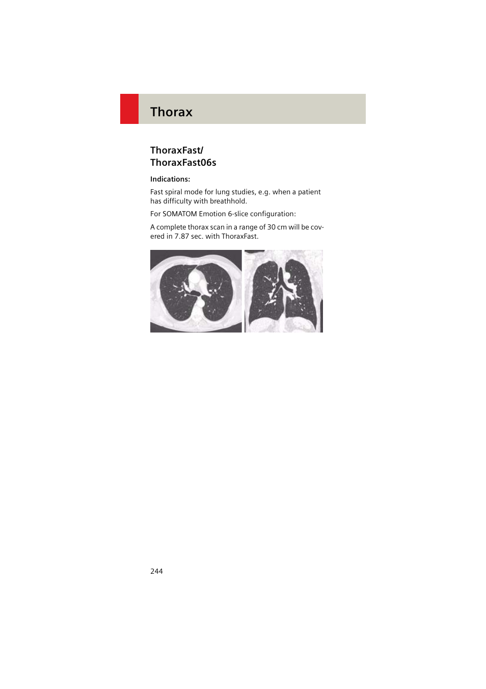 Thoraxfast/ thoraxfast06s, Thoraxfast, Thoraxfast06s 244 | Thorax | Siemens EMOTION 16-Jun User Manual | Page 244 / 590