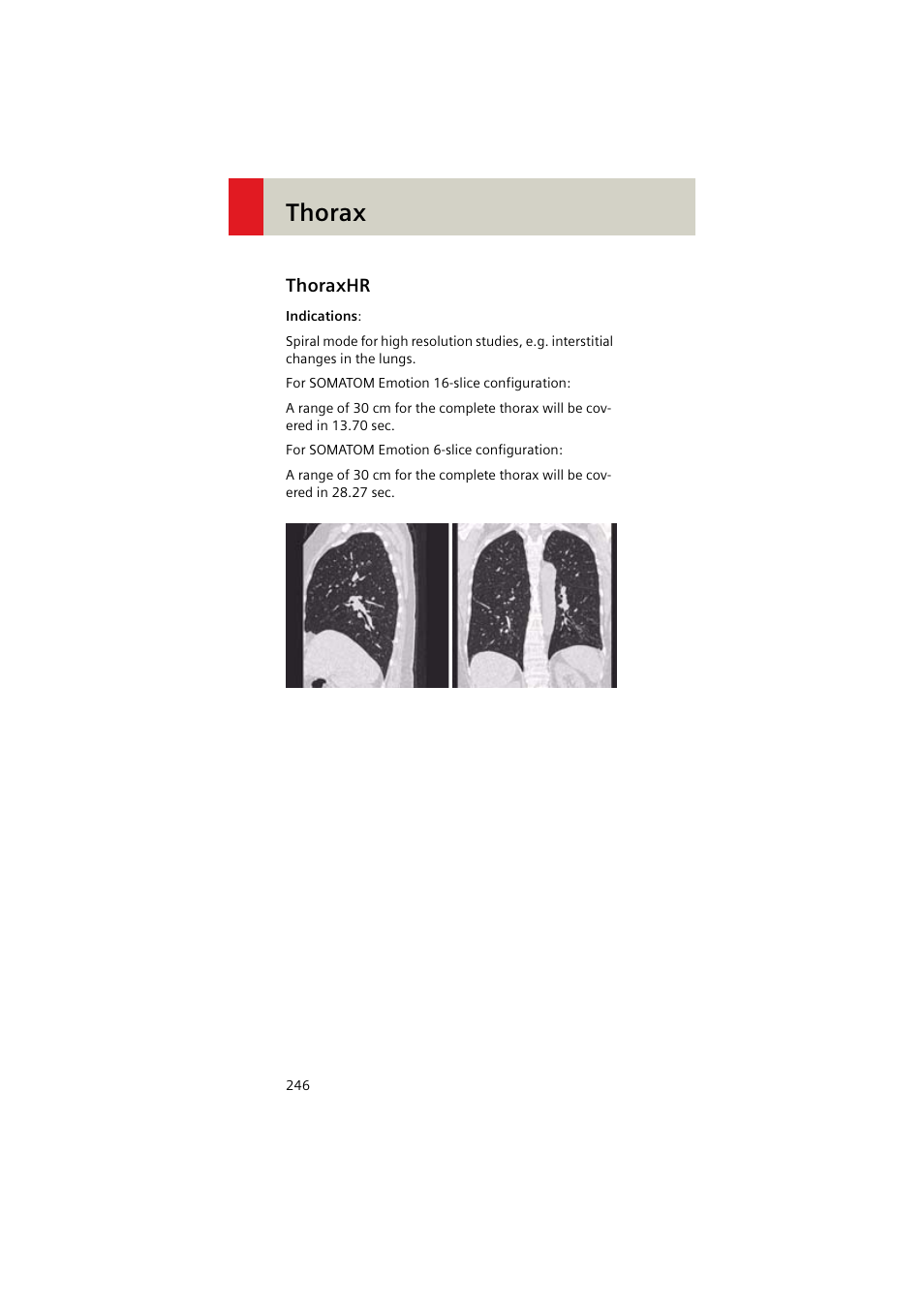 Thoraxhr, Thoraxhr 246, Thorax | Siemens EMOTION 16-Jun User Manual | Page 246 / 590