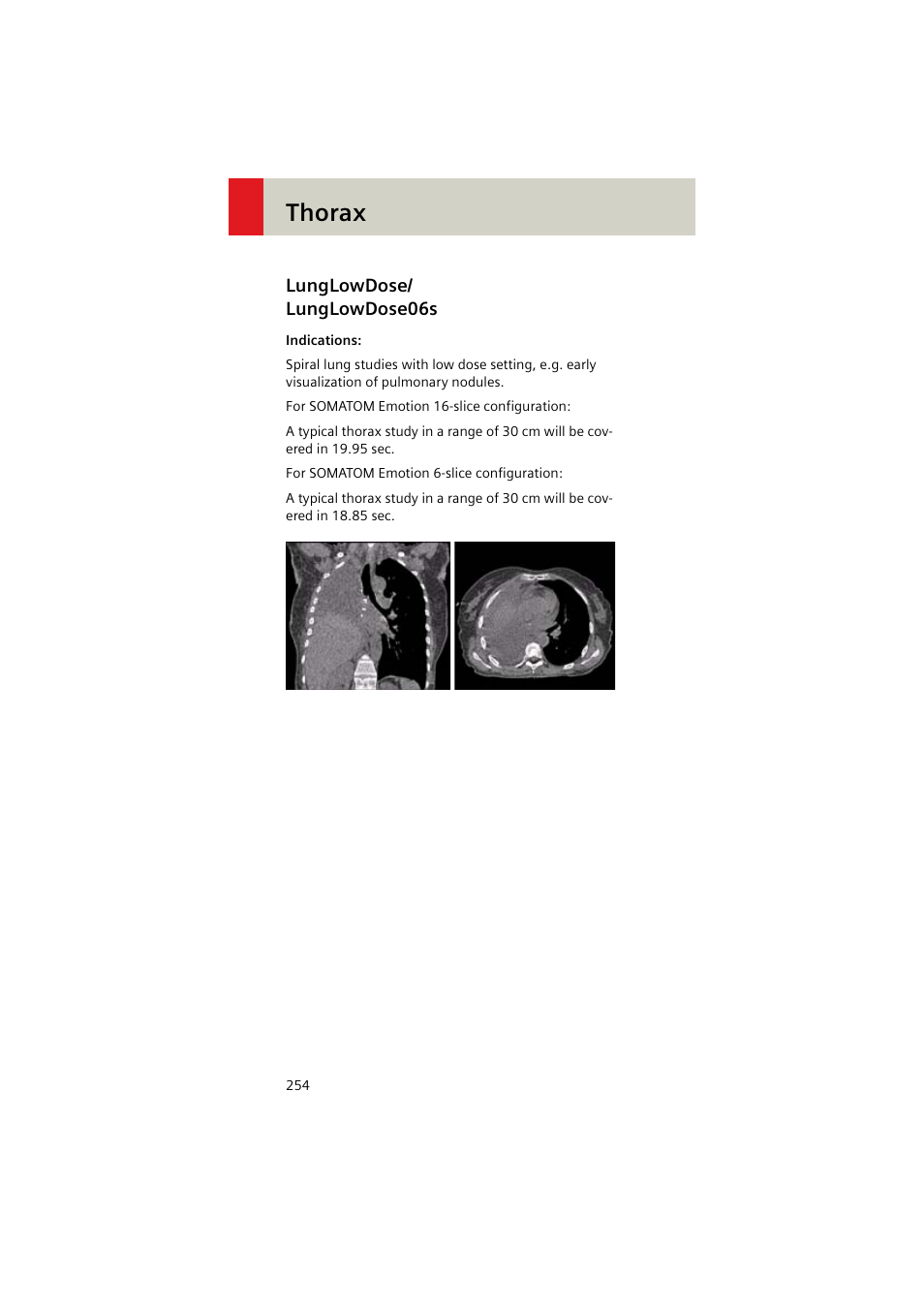 Lunglowdose/ lunglowdose06s, Lunglowdose, Lunglowdose06s 254 | Thorax | Siemens EMOTION 16-Jun User Manual | Page 254 / 590