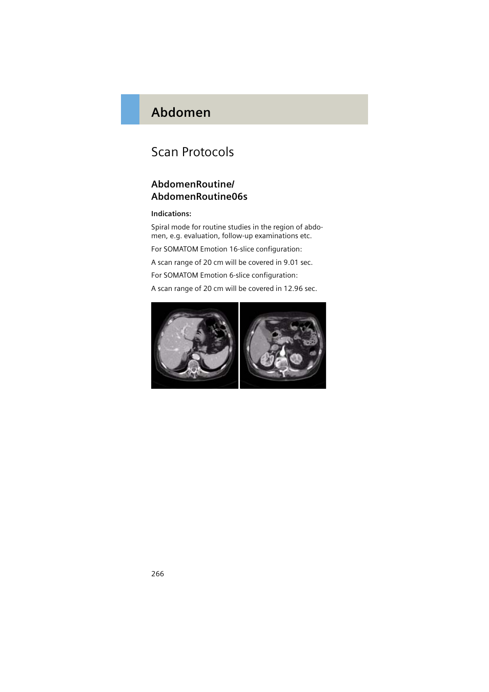 Scan protocols, Abdomenroutine/ abdomenroutine06s, Abdomenroutine | Abdomenroutine06s 266, Abdomen scan protocols | Siemens EMOTION 16-Jun User Manual | Page 266 / 590