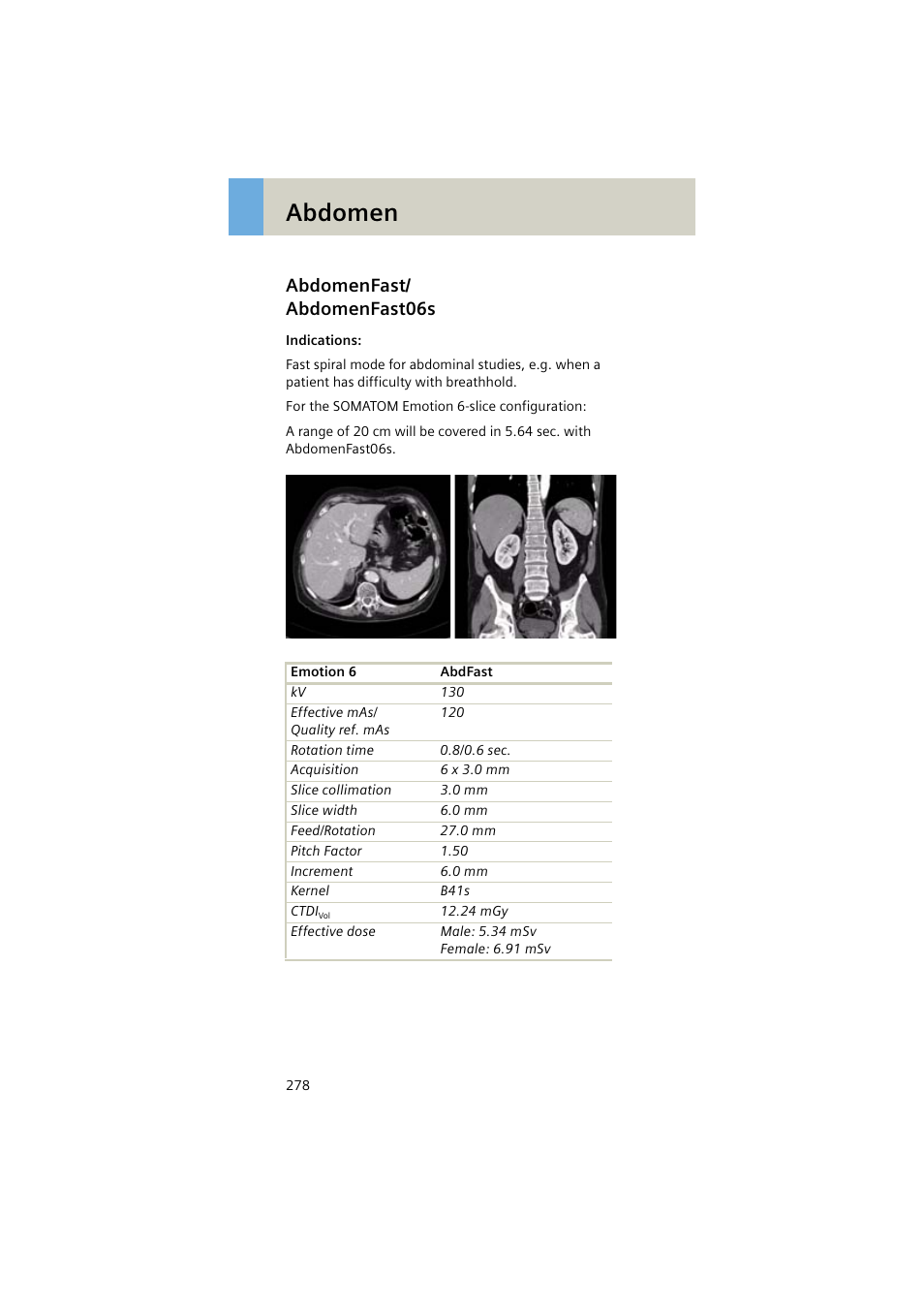 Abdomenfast/ abdomenfast06s, Abdomenfast, Abdomenfast06s 278 | Abdomen | Siemens EMOTION 16-Jun User Manual | Page 278 / 590