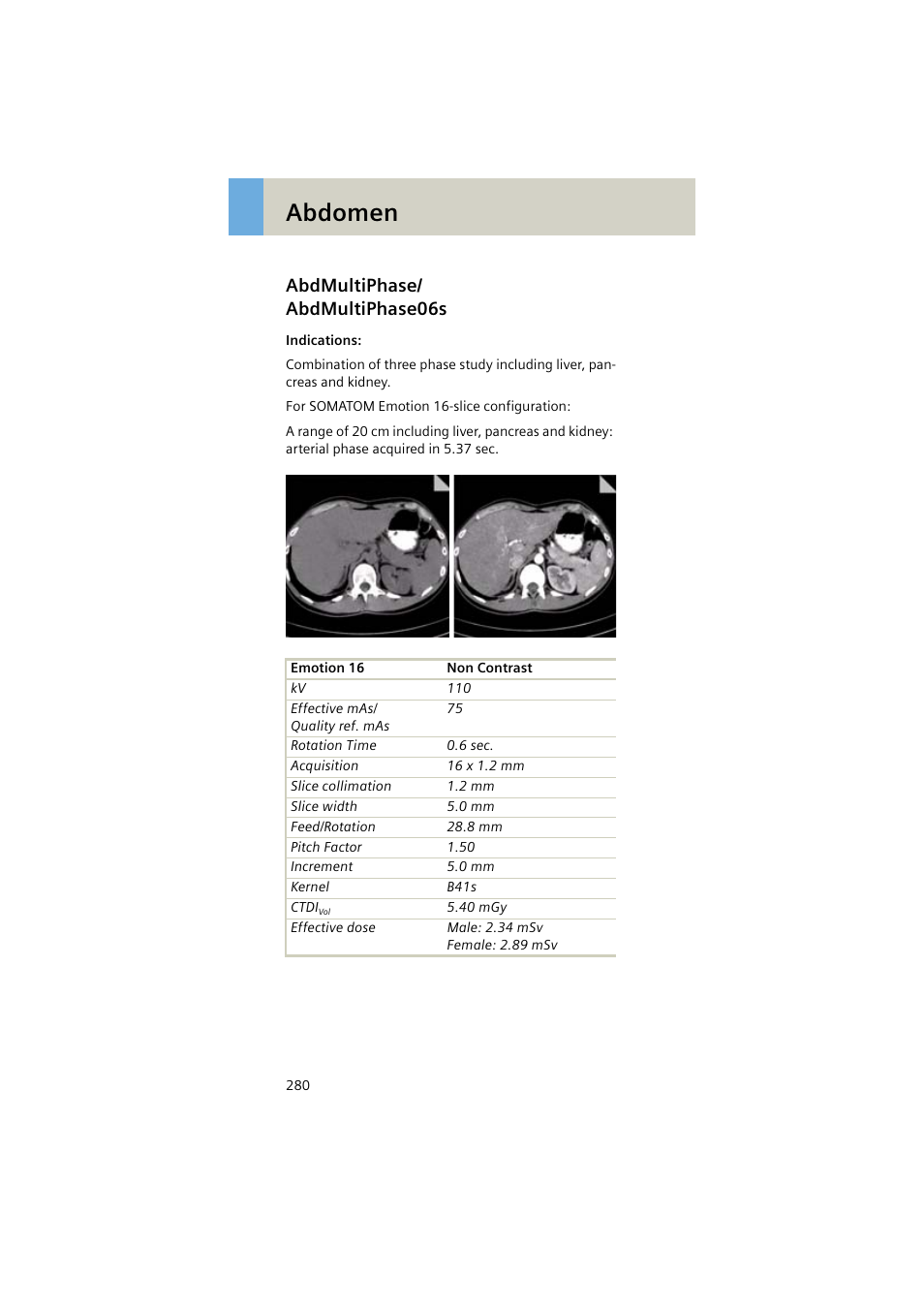 Abdmultiphase/ abdmultiphase06s, Abdmultiphase, Abdmultiphase06s 280 | Abdomen | Siemens EMOTION 16-Jun User Manual | Page 280 / 590