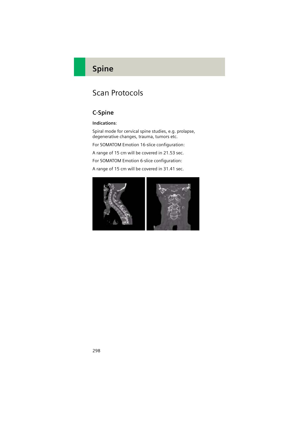 Scan protocols, C-spine, C-spine 298 | Spine scan protocols | Siemens EMOTION 16-Jun User Manual | Page 298 / 590