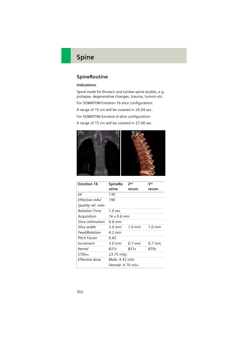 Spineroutine, Spineroutine 302, Spine | Siemens EMOTION 16-Jun User Manual | Page 302 / 590