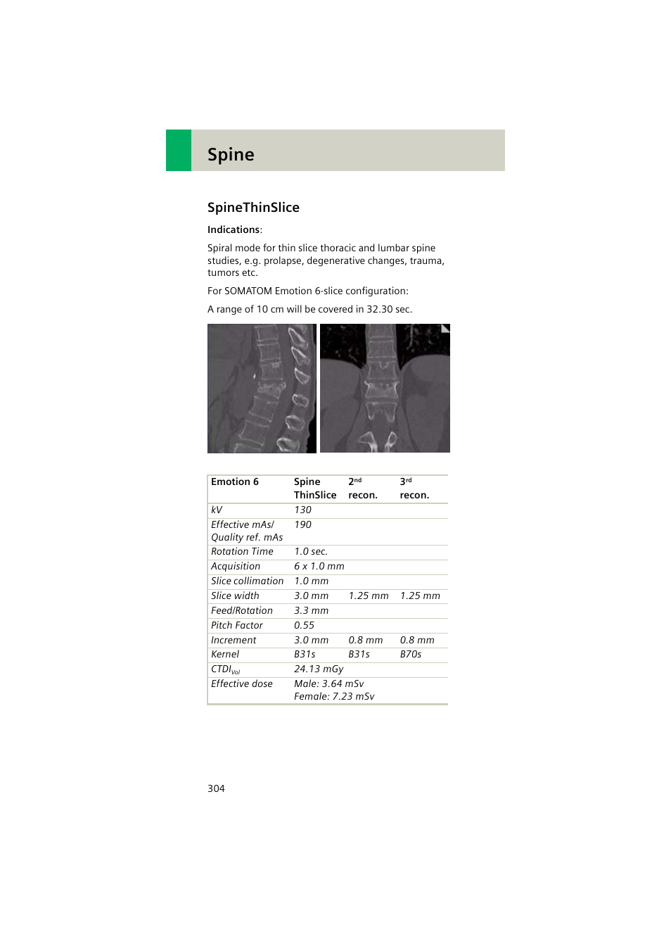 Spinethinslice, Spinethinslice 304, Spine | Siemens EMOTION 16-Jun User Manual | Page 304 / 590